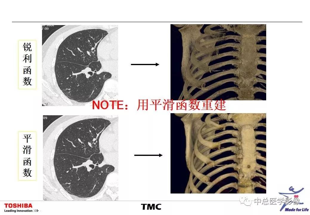 影像PPT - 【PPT】CT三维后处理技术应用-14