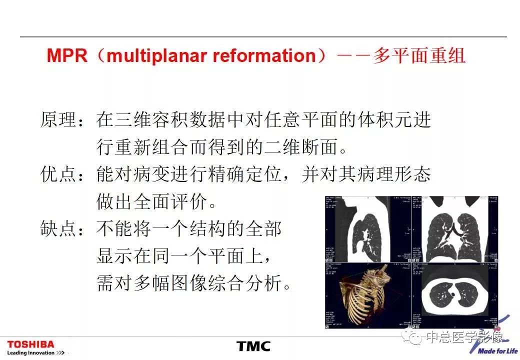 影像PPT - 【PPT】CT三维后处理技术应用-15