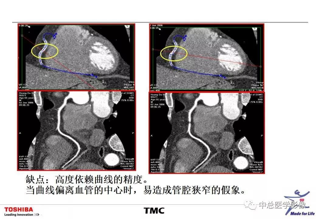 影像PPT - 【PPT】CT三维后处理技术应用-19