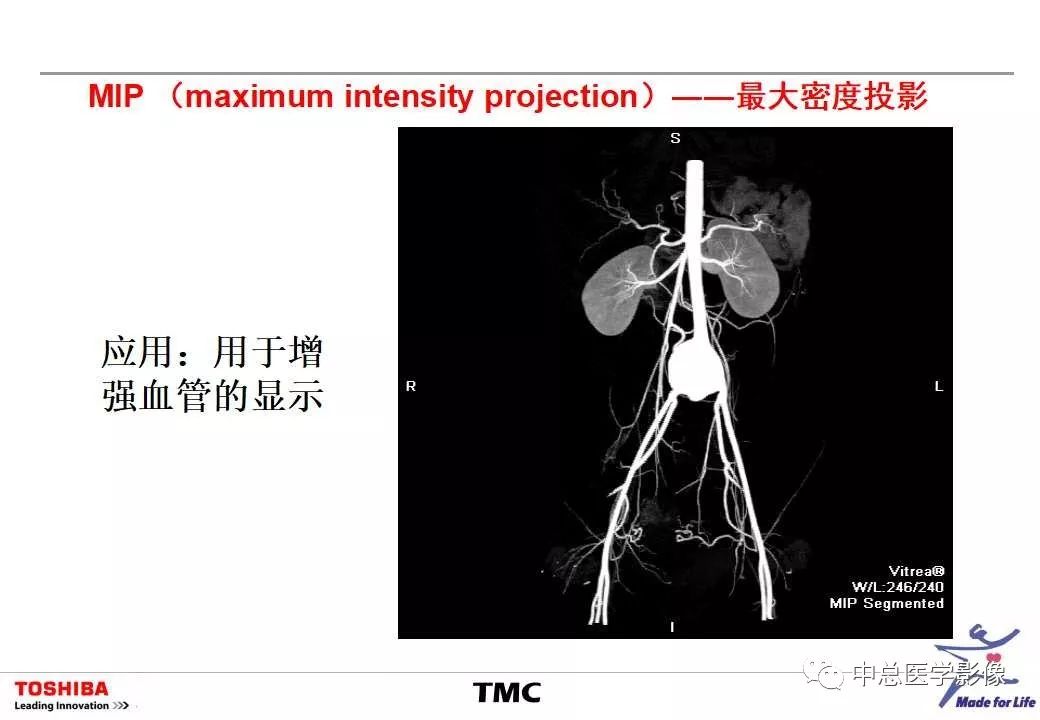 影像PPT - 【PPT】CT三维后处理技术应用-20