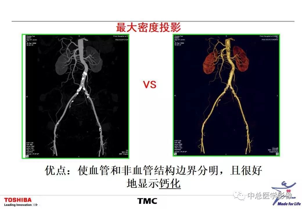 影像PPT - 【PPT】CT三维后处理技术应用-22