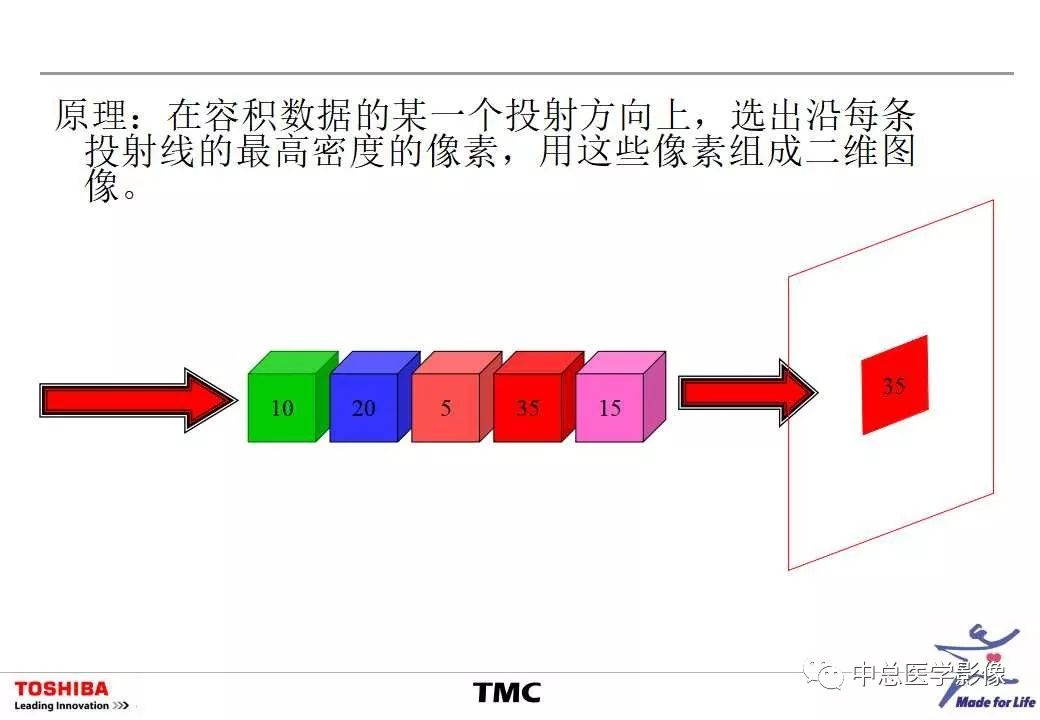影像PPT - 【PPT】CT三维后处理技术应用-21