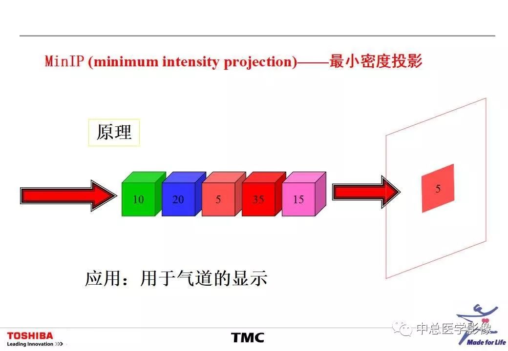 影像PPT - 【PPT】CT三维后处理技术应用-26