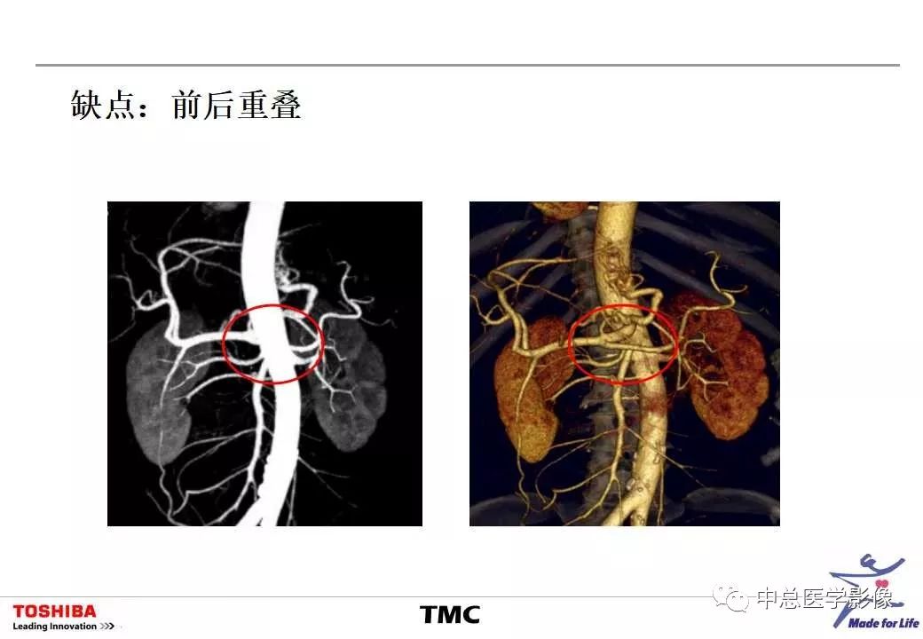 影像PPT - 【PPT】CT三维后处理技术应用-25