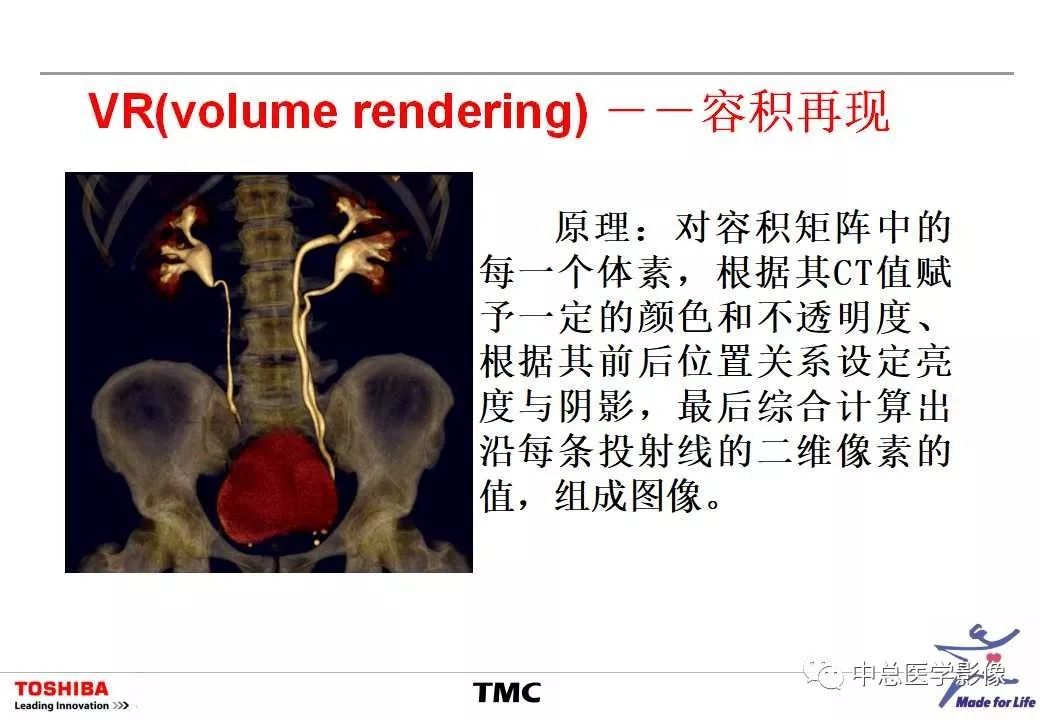 影像PPT - 【PPT】CT三维后处理技术应用-28