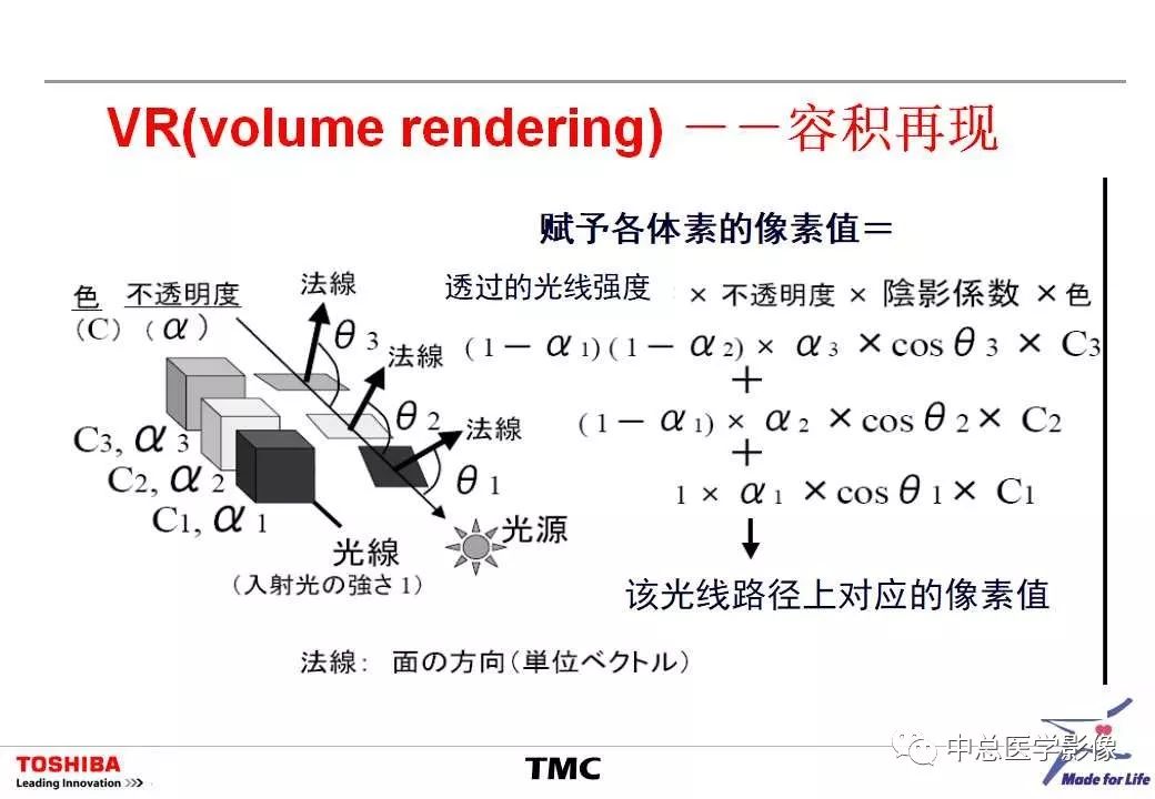 影像PPT - 【PPT】CT三维后处理技术应用-32
