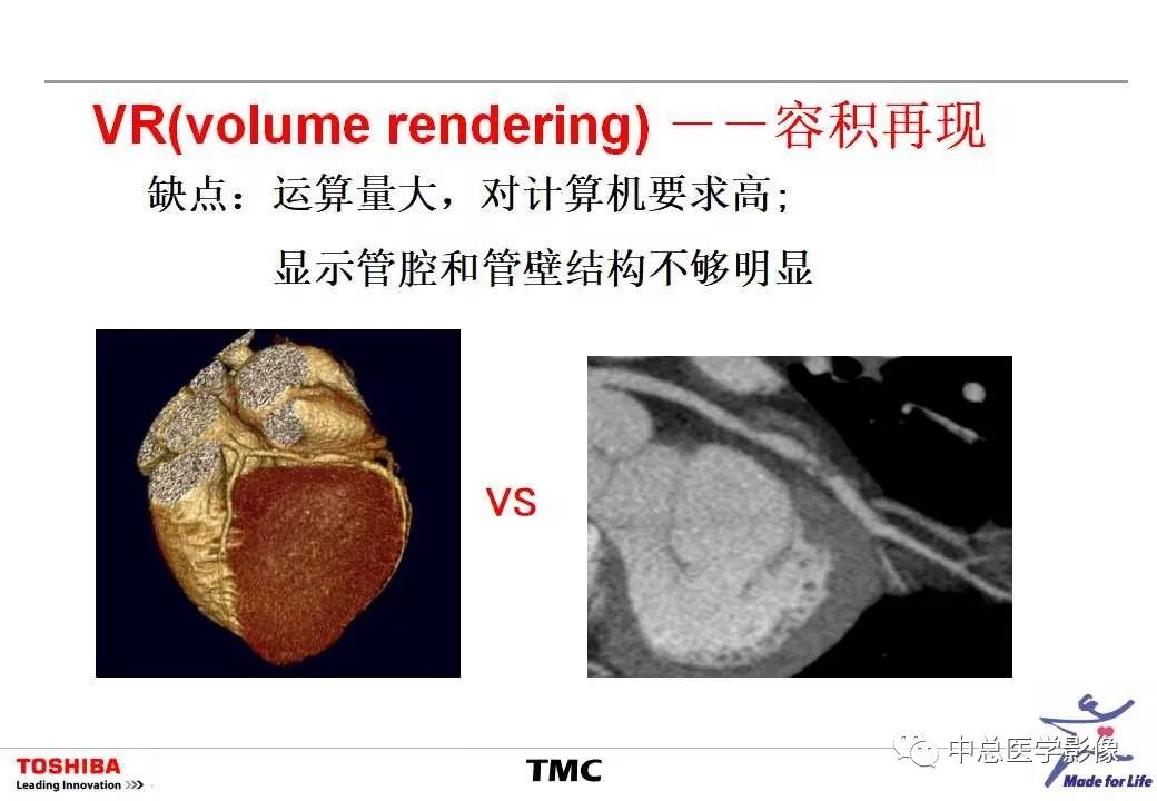 影像PPT - 【PPT】CT三维后处理技术应用-37