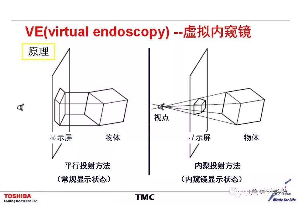 影像PPT - 【PPT】CT三维后处理技术应用-39