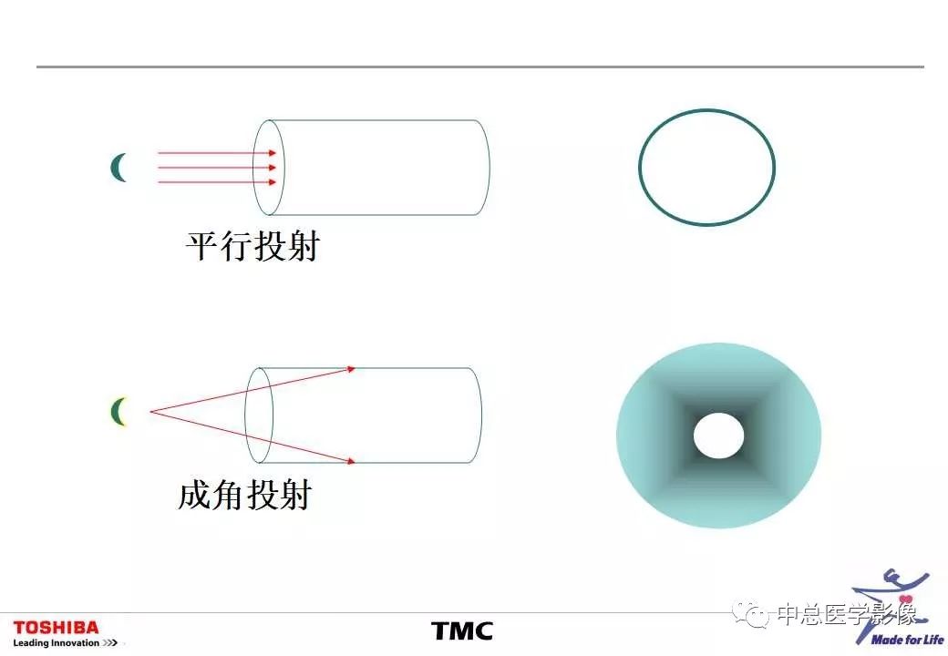 影像PPT - 【PPT】CT三维后处理技术应用-40