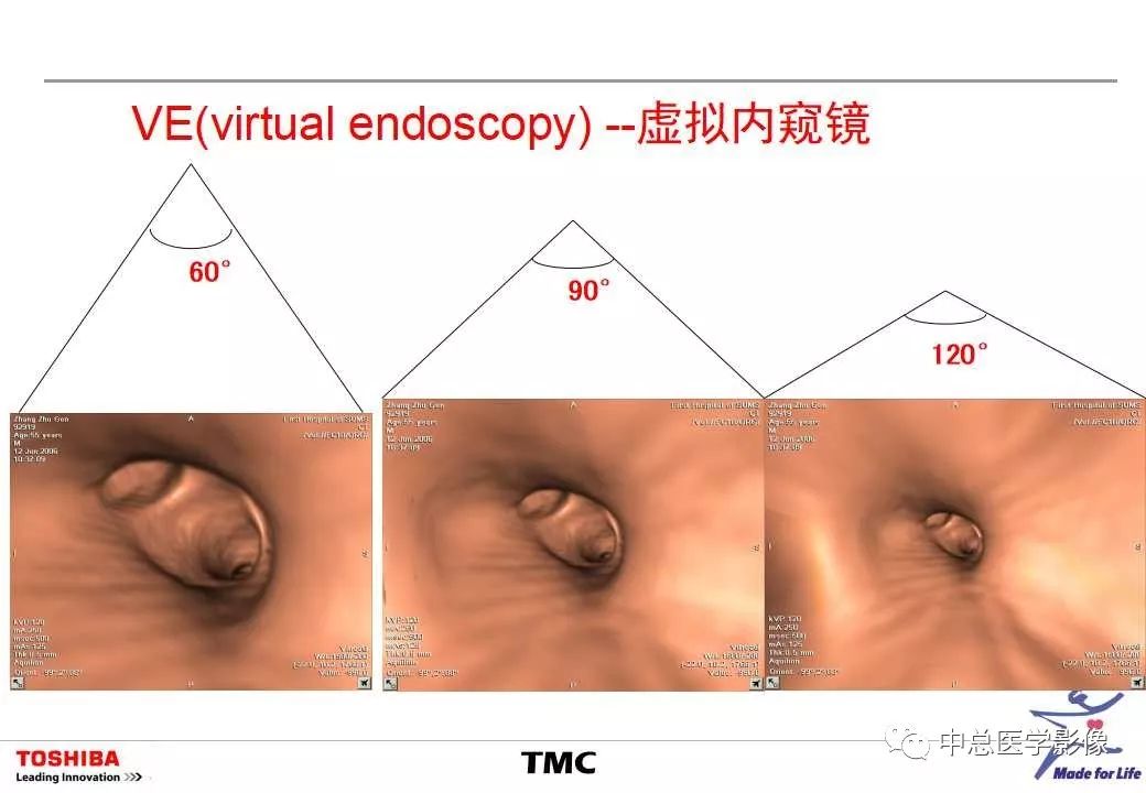 影像PPT - 【PPT】CT三维后处理技术应用-41