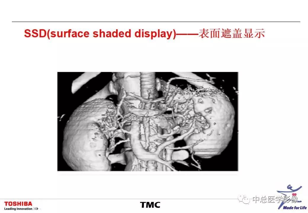 影像PPT - 【PPT】CT三维后处理技术应用-47