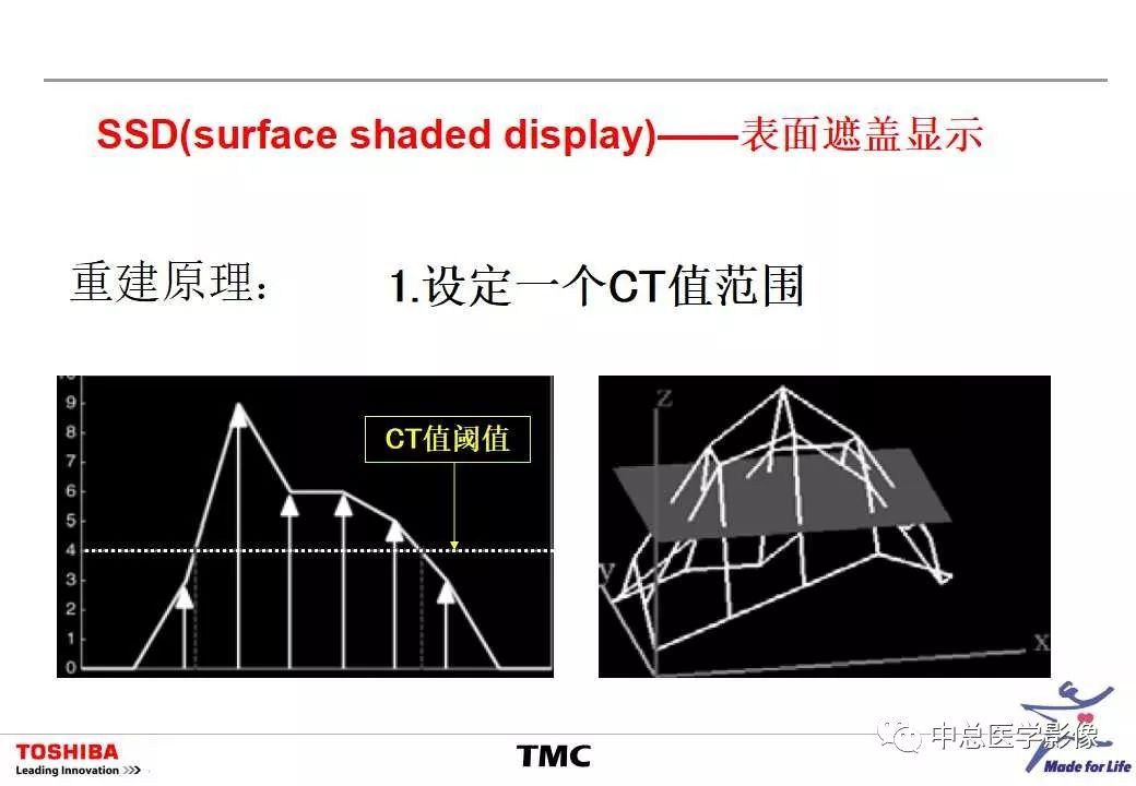 影像PPT - 【PPT】CT三维后处理技术应用-48