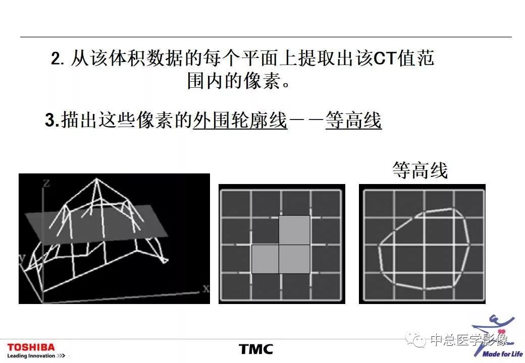 影像PPT - 【PPT】CT三维后处理技术应用-49
