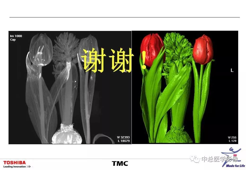 影像PPT - 【PPT】CT三维后处理技术应用-52