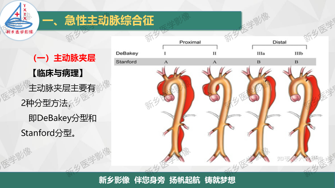 影像PPT - 【PPT】医学影像诊断学教材解读—主动脉病变的影像表现-4