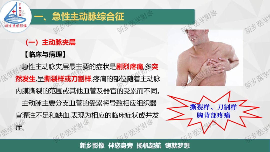影像PPT - 【PPT】医学影像诊断学教材解读—主动脉病变的影像表现-5