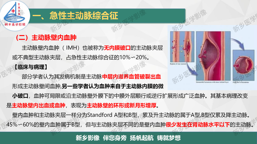 影像PPT - 【PPT】医学影像诊断学教材解读—主动脉病变的影像表现-13