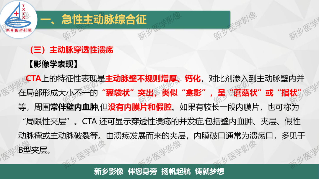 影像PPT - 【PPT】医学影像诊断学教材解读—主动脉病变的影像表现-18