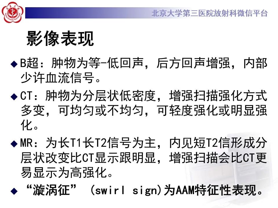 影像PPT - 【PPT】侵袭性血管粘液瘤-13