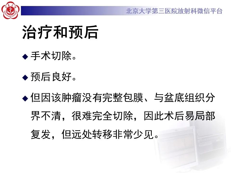 影像PPT - 【PPT】侵袭性血管粘液瘤-18