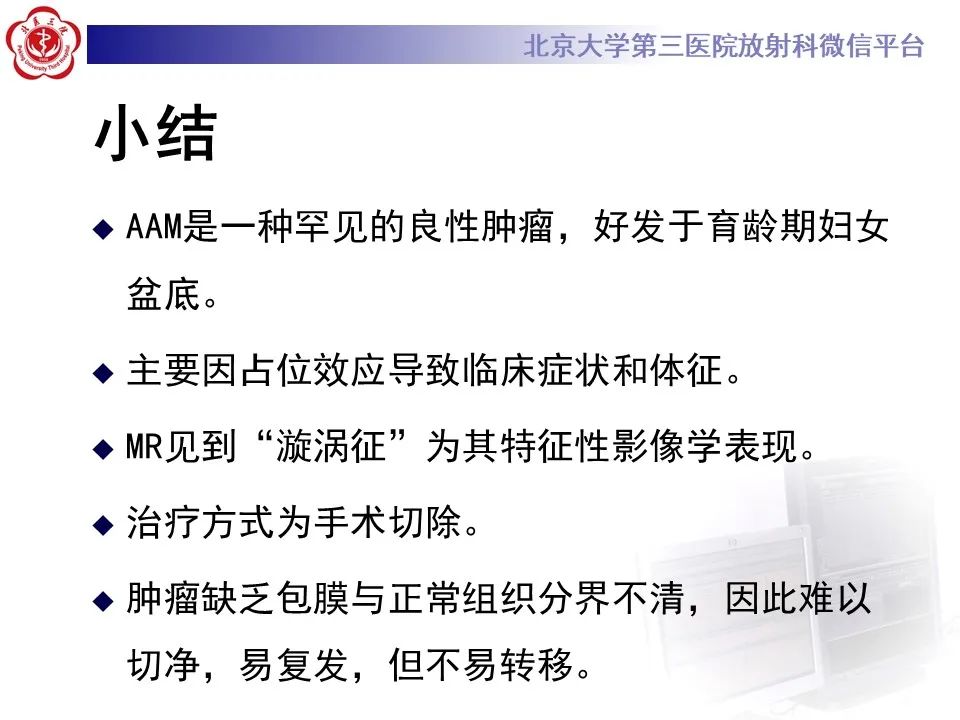 影像PPT - 【PPT】侵袭性血管粘液瘤-19