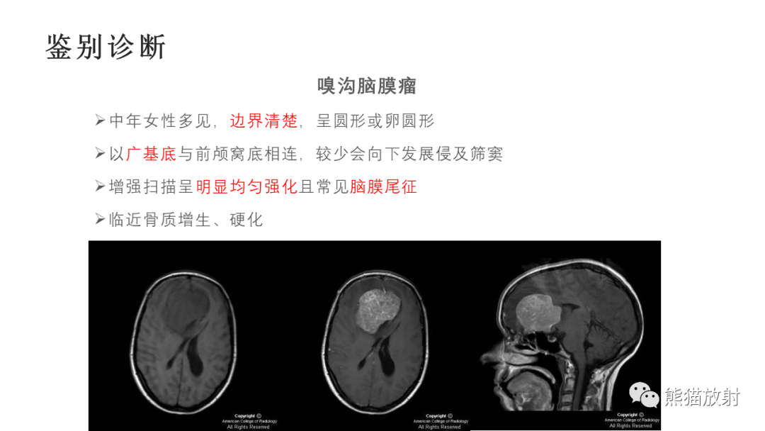 影像PPT - 【病例】嗅神经母细胞瘤2例MR-41