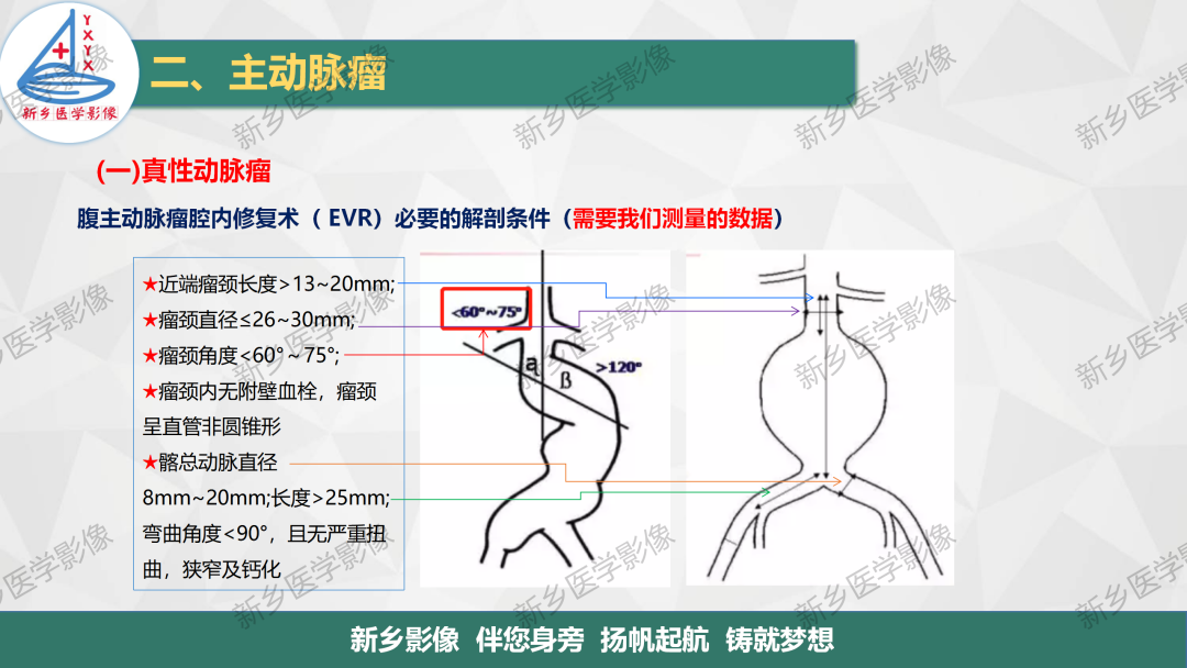 影像PPT - 【PPT】医学影像诊断学教材解读—主动脉病变的影像表现-6