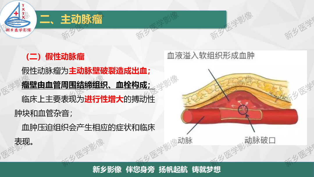 影像PPT - 【PPT】医学影像诊断学教材解读—主动脉病变的影像表现-7