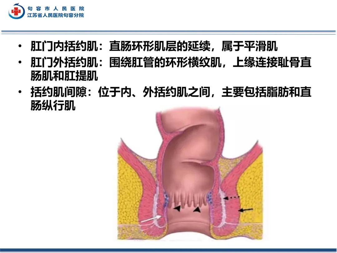 影像PPT - 【PPT】肛瘘-9