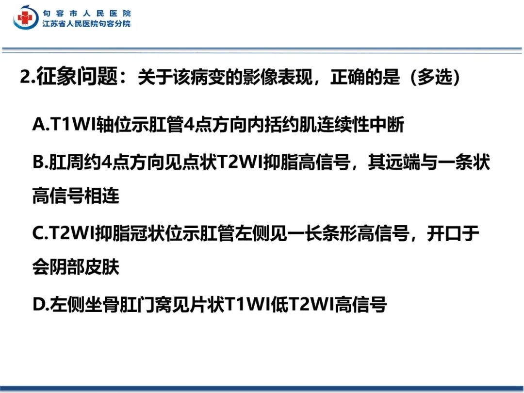 影像PPT - 【PPT】肛瘘-10