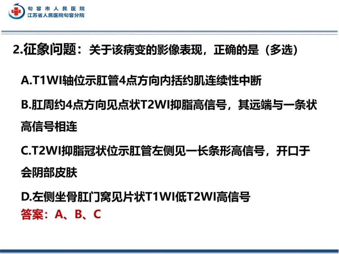 影像PPT - 【PPT】肛瘘-11