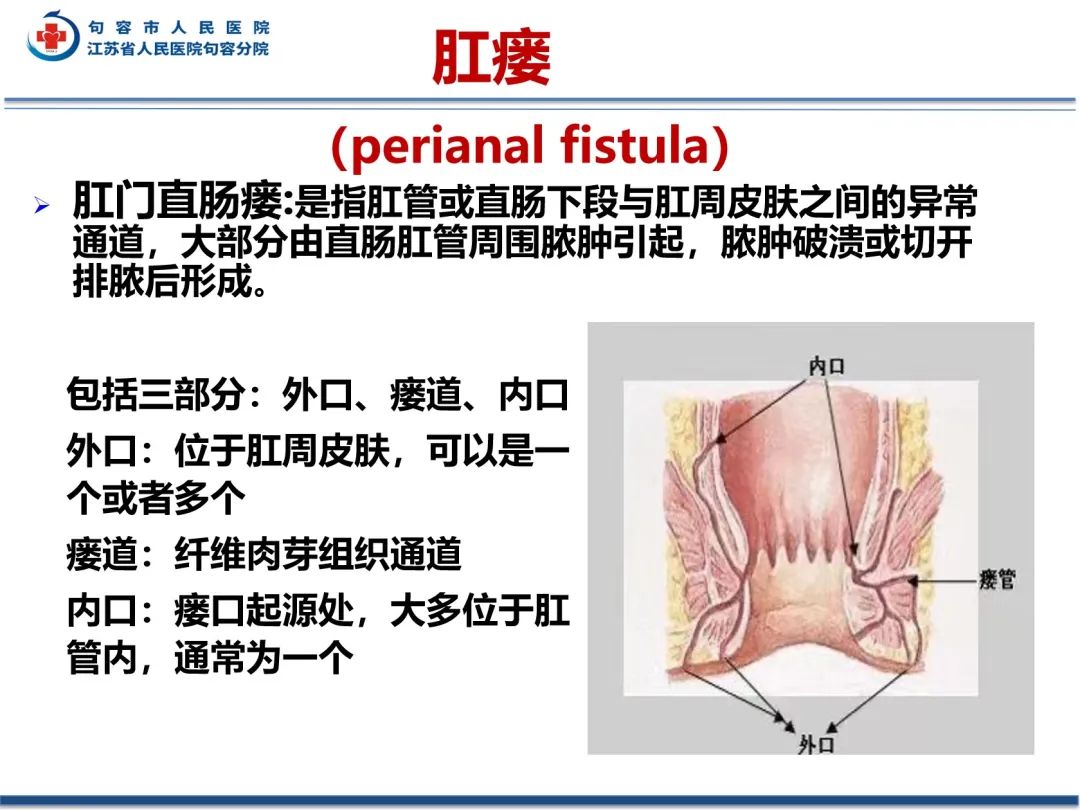 影像PPT - 【PPT】肛瘘-15