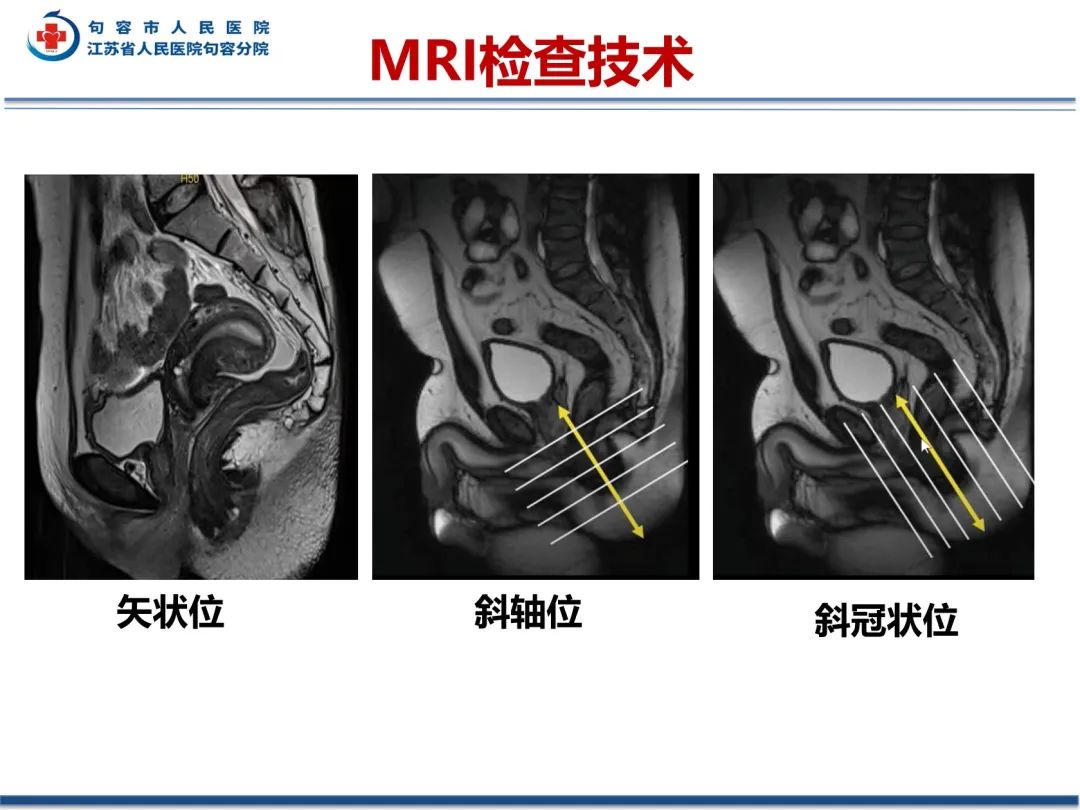 影像PPT - 【PPT】肛瘘-19