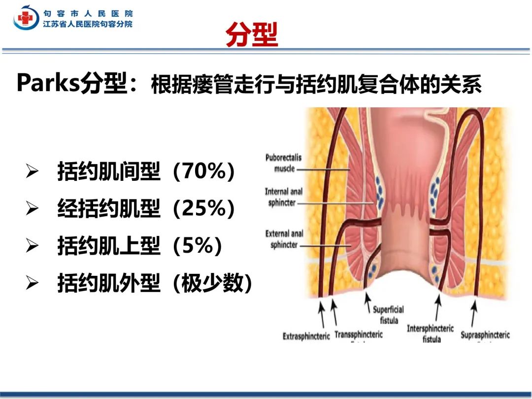 影像PPT - 【PPT】肛瘘-24