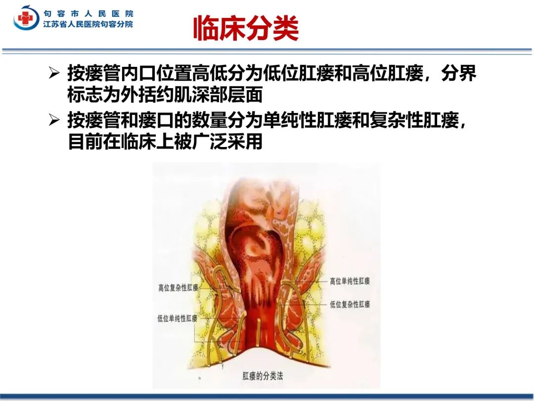 影像PPT - 【PPT】肛瘘-35