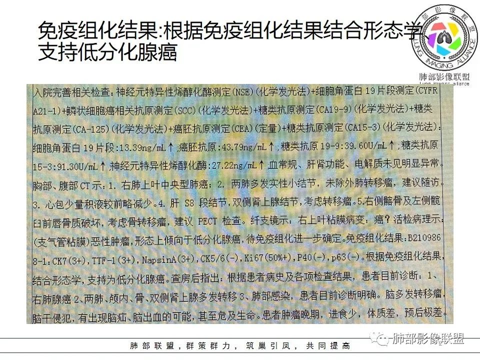 影像PPT - 【病例】15岁少女,肺脑同时病变,结果很意外-49 影像PPT - 【病例】15岁少女,肺脑同时病变,结果很意外-49
