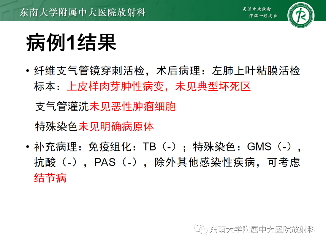 影像PPT - 【PPT】多发性淋巴结增大影像诊断思路-8 影像PPT - 【PPT】多发性淋巴结增大影像诊断思路-8