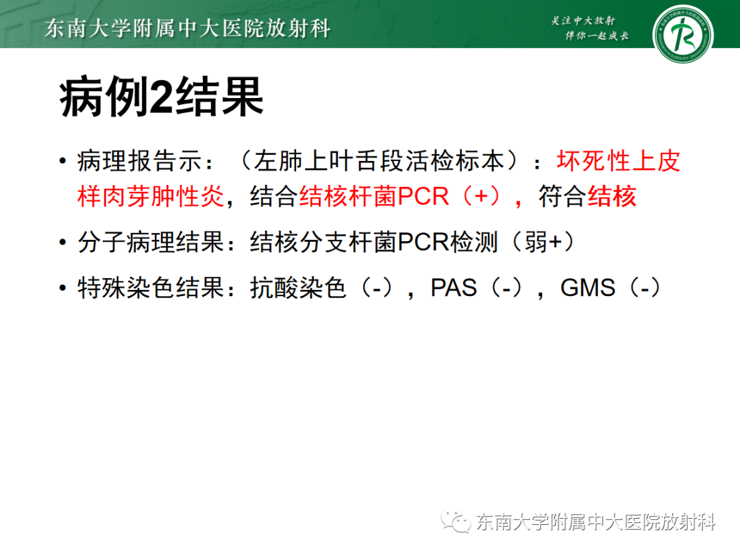 影像PPT - 【PPT】多发性淋巴结增大影像诊断思路-9 影像PPT - 【PPT】多发性淋巴结增大影像诊断思路-9