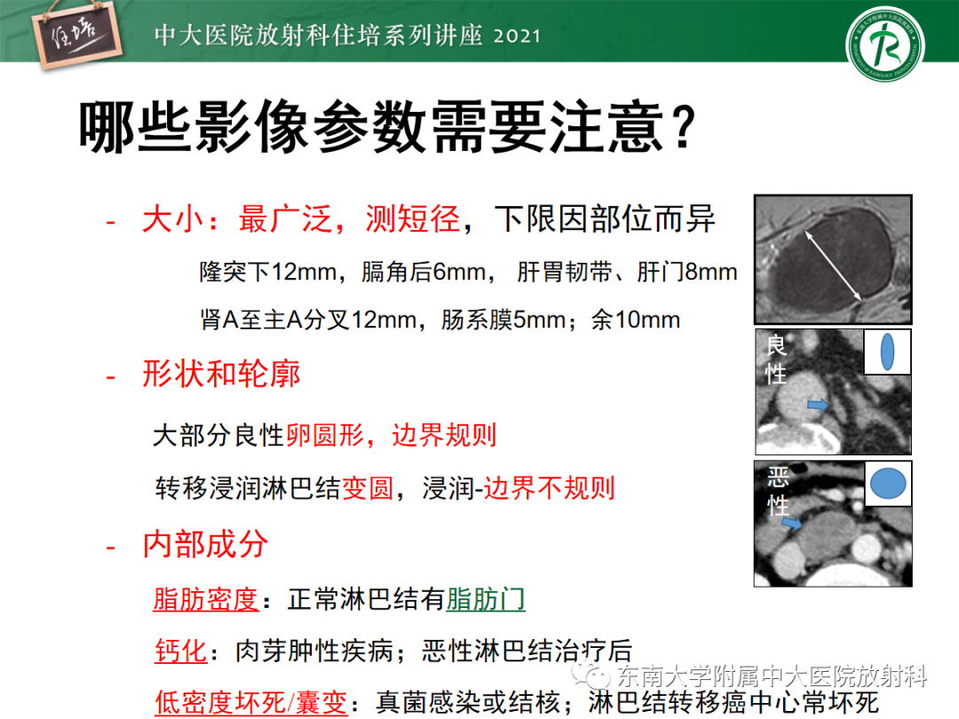 影像PPT - 【PPT】多发性淋巴结增大影像诊断思路-24 影像PPT - 【PPT】多发性淋巴结增大影像诊断思路-24