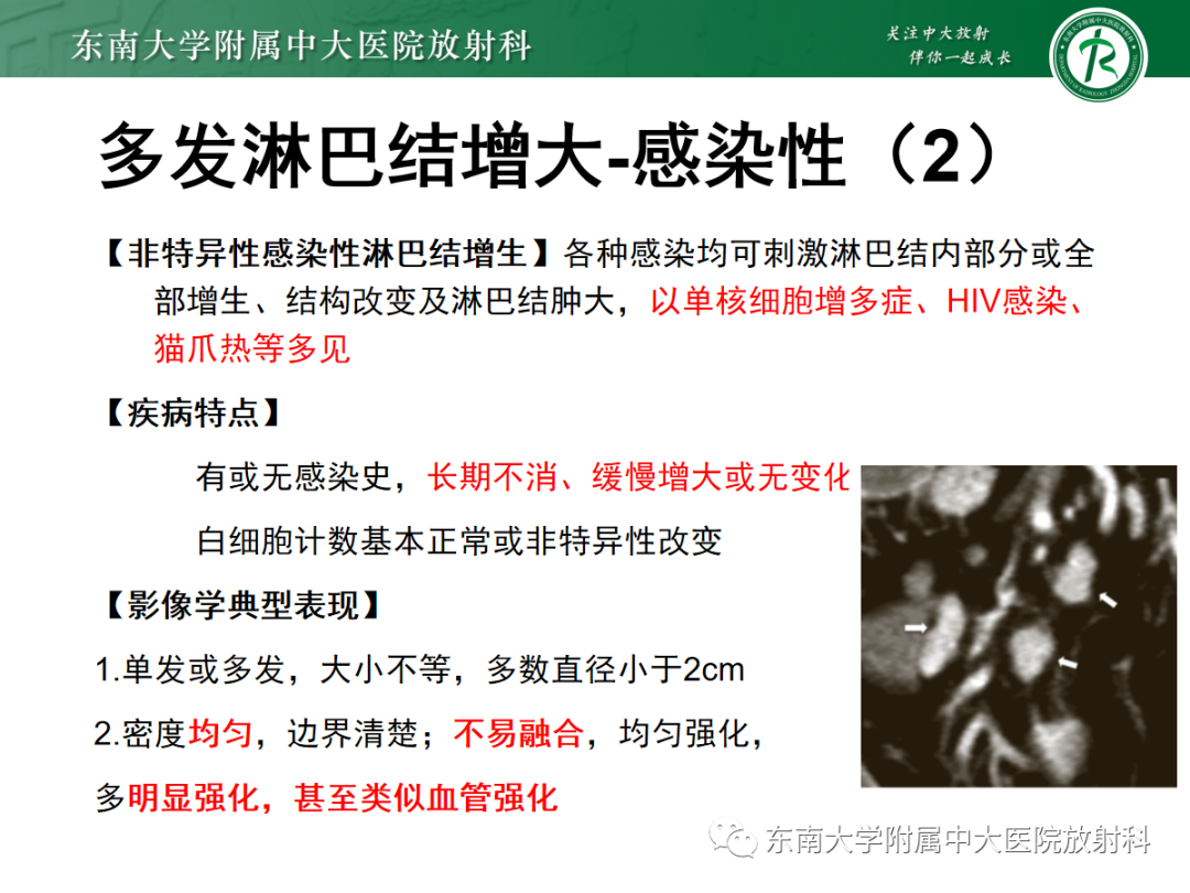 影像PPT - 【PPT】多发性淋巴结增大影像诊断思路-30 影像PPT - 【PPT】多发性淋巴结增大影像诊断思路-30