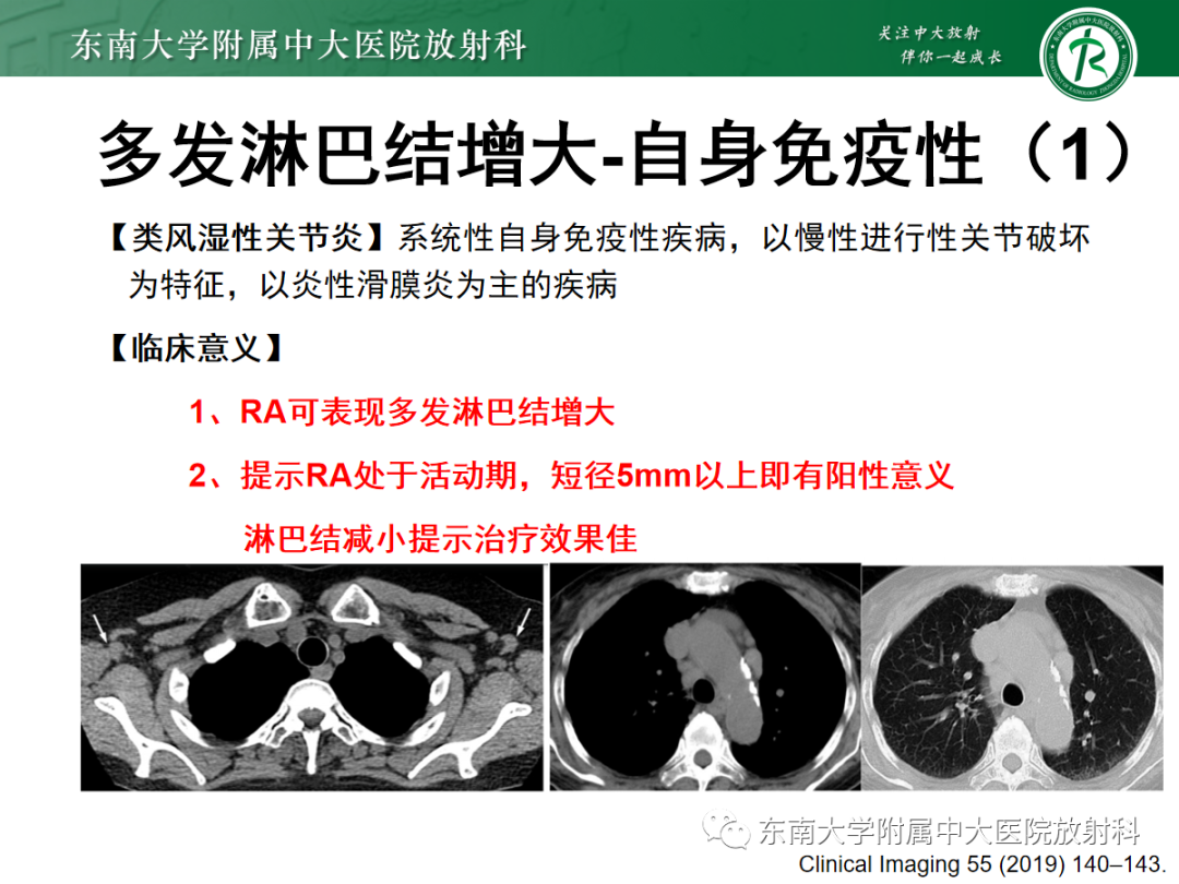 影像PPT - 【PPT】多发性淋巴结增大影像诊断思路-31 影像PPT - 【PPT】多发性淋巴结增大影像诊断思路-31