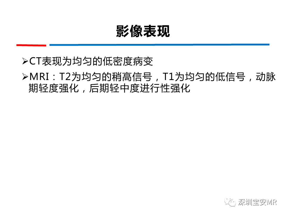 影像PPT - 【PPT】肝脏少见肿瘤-18