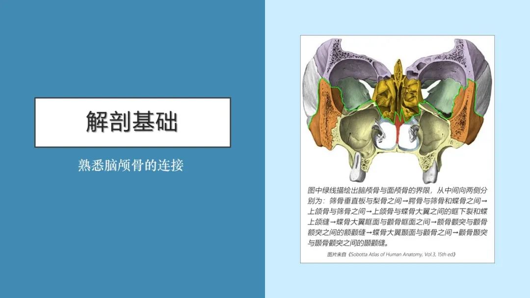 影像PPT - 【PPT】颅骨的孔裂、缝及骨折线CT读片-3