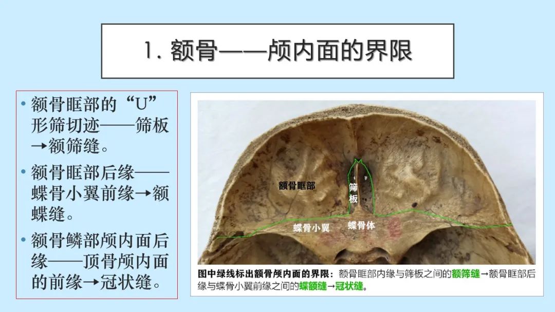 影像PPT - 【PPT】颅骨的孔裂、缝及骨折线CT读片-5