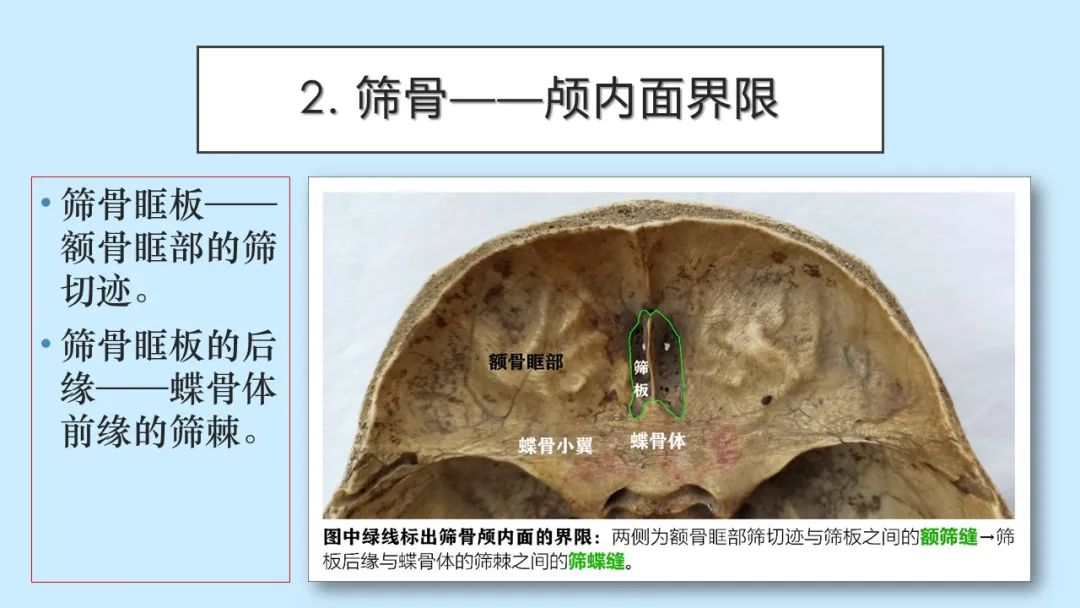 影像PPT - 【PPT】颅骨的孔裂、缝及骨折线CT读片-7
