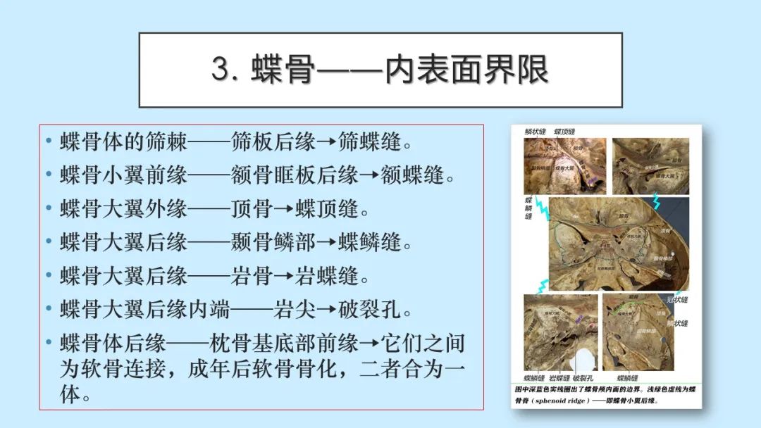 影像PPT - 【PPT】颅骨的孔裂、缝及骨折线CT读片-9