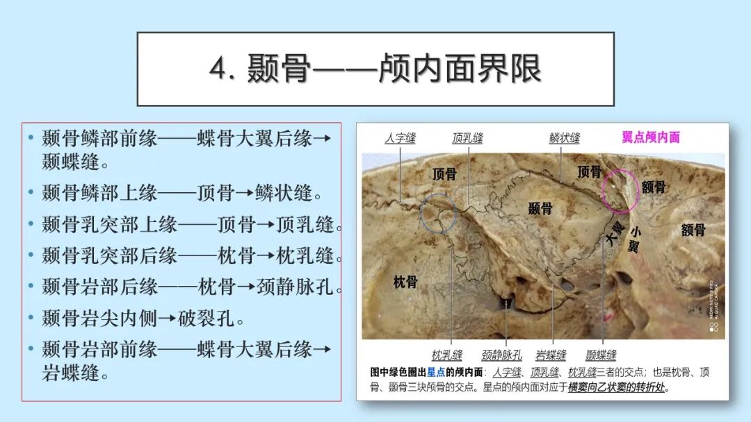 影像PPT - 【PPT】颅骨的孔裂、缝及骨折线CT读片-11