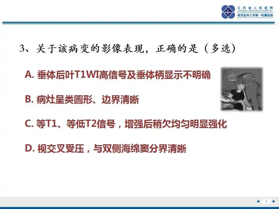 影像PPT - 【PPT】神经垂体颗粒细胞瘤-15