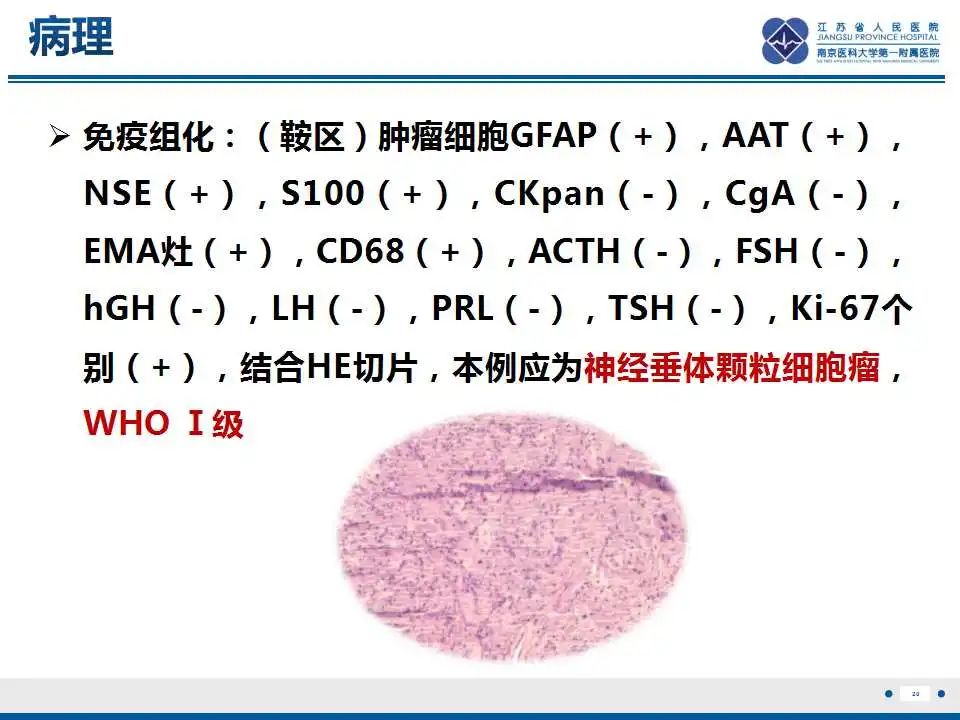 影像PPT - 【PPT】神经垂体颗粒细胞瘤-21