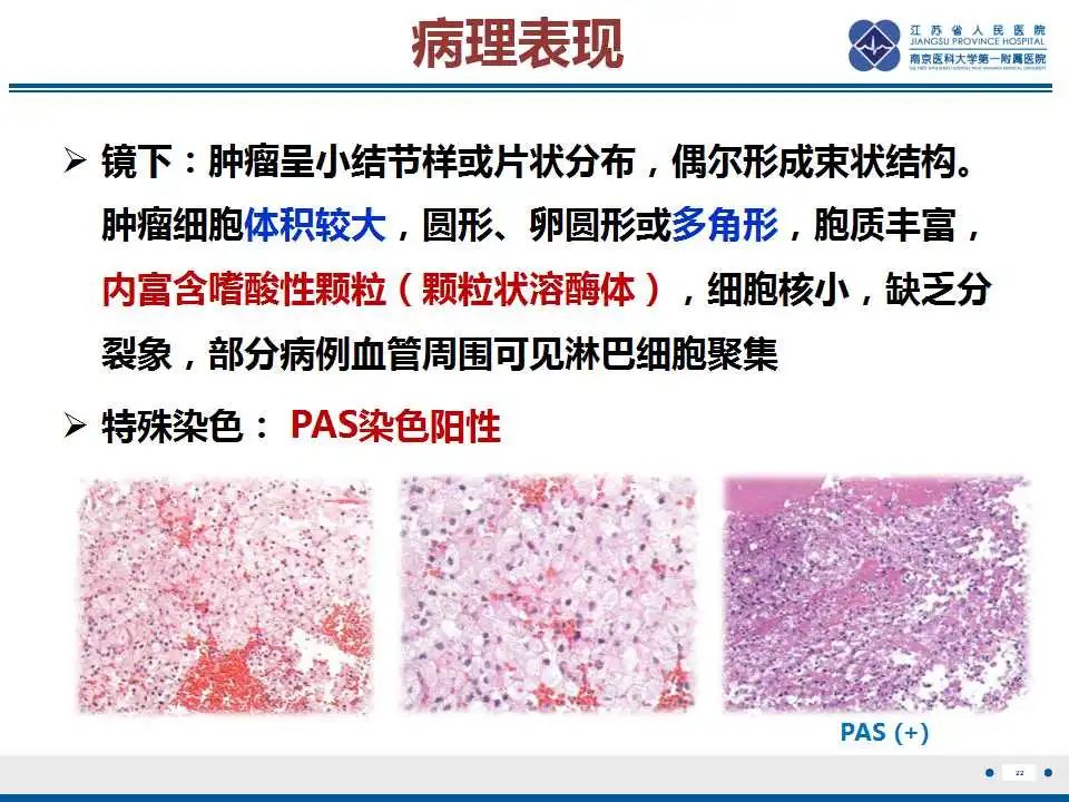 影像PPT - 【PPT】神经垂体颗粒细胞瘤-23